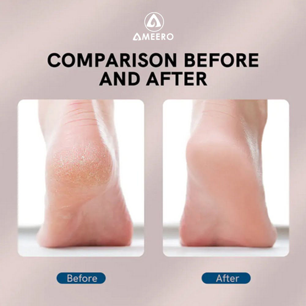 Ameero Electric Foot Hard Skin Remover – Your New Care Essential - Image 4
