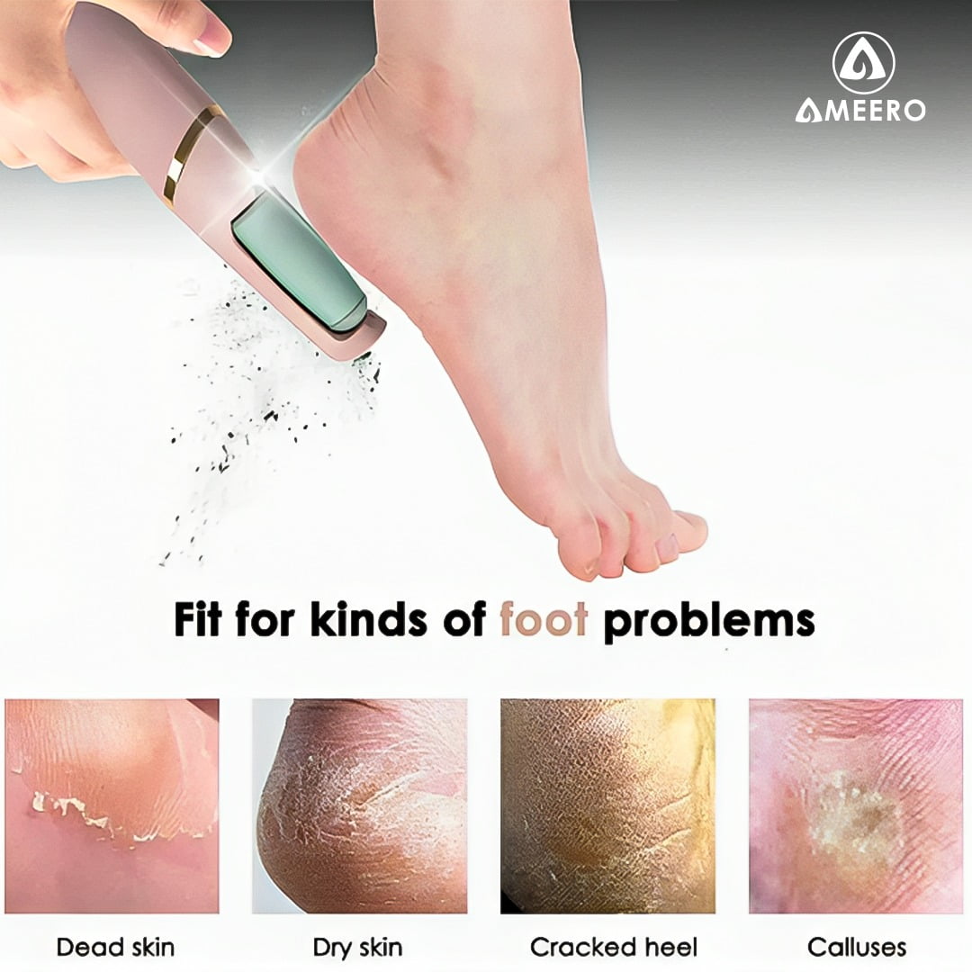 Ameero Electric Foot Hard Skin Remover – Your New Care Essential - Image 5
